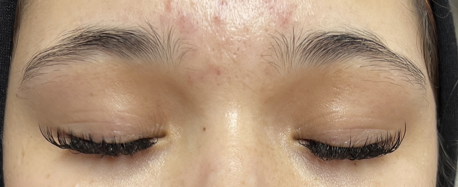 After Brow Lamination