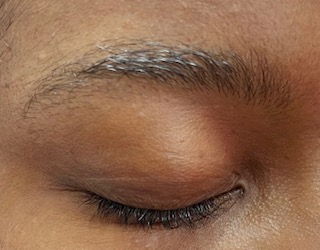 After Microblading